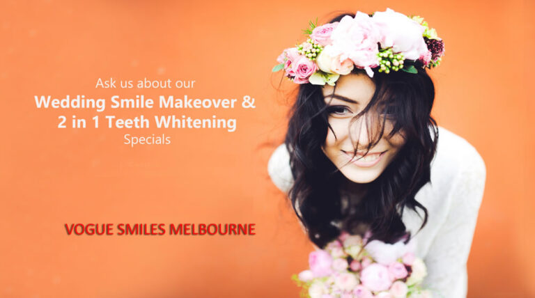 Bridal Smile Makeover