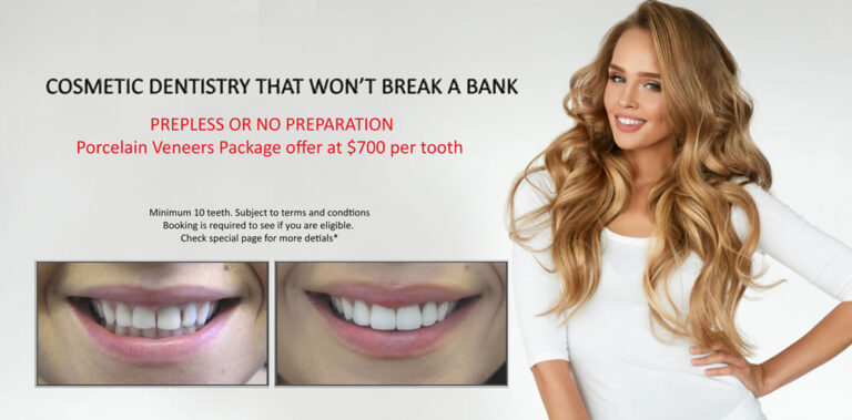 Bridal Smile Makeover