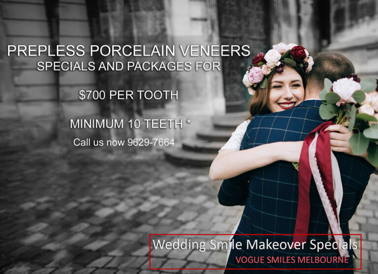 Bridal Smile Makeover