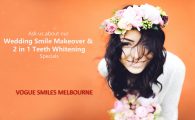 Bridal Smile Makeover Bridal Smile Makeover